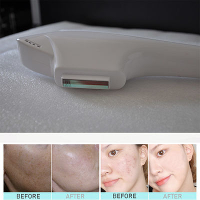 qmmadical 2 in 1 IPL + diode laser Hair Removal beauty machine