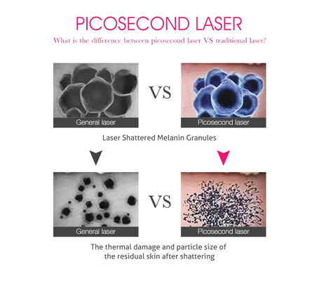 FDA approved Picosure Laser 755nm Professional Tattoo Removal Machine